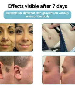 LUMIVO™ All-in-One CO₂ Laser Eraser Pen