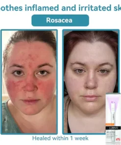 LUMIVO™ All-in-One CO₂ Laser Eraser Pen