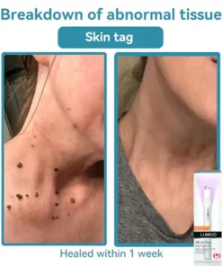 LUMIVO™ All-in-One CO₂ Laser Eraser Pen