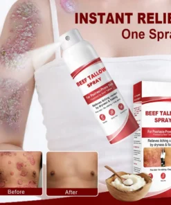 OUR+™ Beef Tallow Spray for Itchy, Flaky Psoriasis Skin