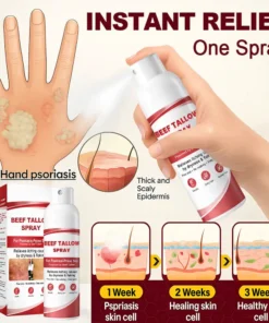 OUR+™ Beef Tallow Spray for Itchy, Flaky Psoriasis Skin