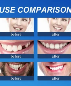 Rianmond™ Medical Full Denture with Strong Suctiond