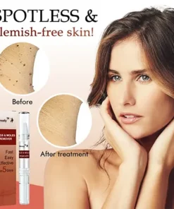 Slimoly® Tags & Moles Remover