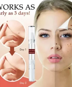 Slimoly® Tags & Moles Remover