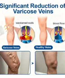 VERVEBEAD™ Vein Ease Microneedle Patch