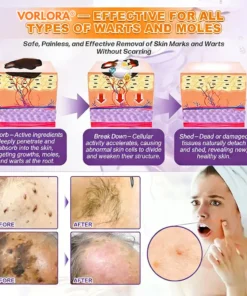 VORLORA® Biotin 10-in-1 Skin Restoration Cream