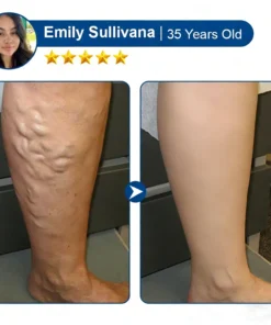 Virexo™ 𝑽𝗲𝗶𝙣 𝘾𝐨𝐧𝘁𝗼𝙪𝙧 𝙈𝙞𝐜𝐫𝒐𝒏𝒆𝗲𝗱𝗹𝙚 𝙋𝙖𝐭𝐜𝒉