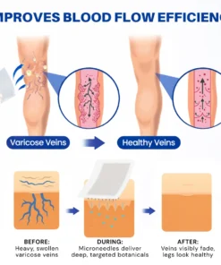 Virexo™ 𝑽𝗲𝗶𝙣 𝘾𝐨𝐧𝘁𝗼𝙪𝙧 𝙈𝙞𝐜𝐫𝒐𝒏𝒆𝗲𝗱𝗹𝙚 𝙋𝙖𝐭𝐜𝒉