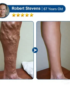 Virexo™ 𝑽𝗲𝗶𝙣 𝘾𝐨𝐧𝘁𝗼𝙪𝙧 𝙈𝙞𝐜𝐫𝒐𝒏𝒆𝗲𝗱𝗹𝙚 𝙋𝙖𝐭𝐜𝒉