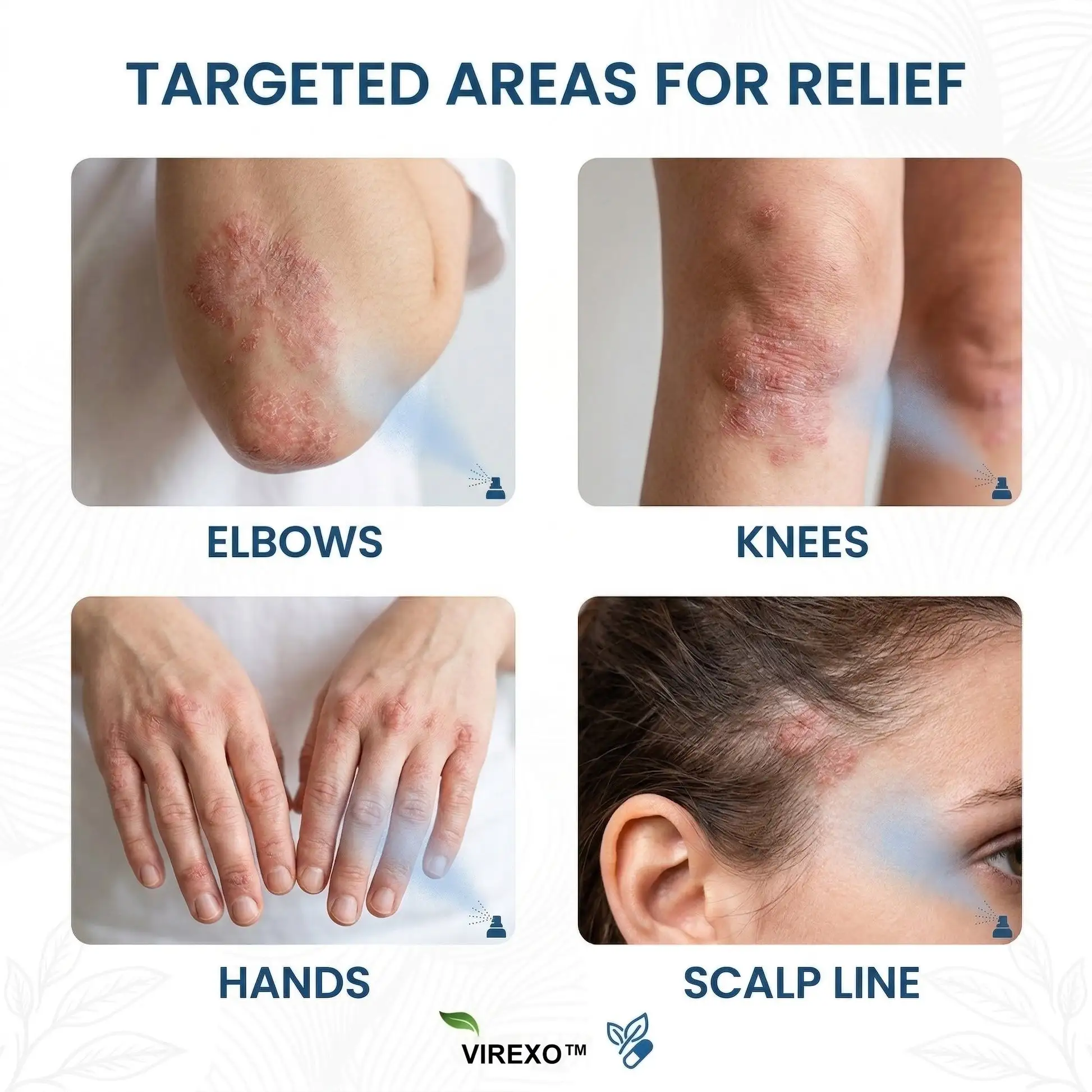 Virexo™ Magnesium Botanical Spray