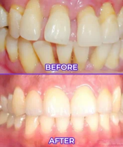 Virexo™ SensiGum Fluoride Toothpaste