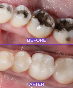 Virexo™ SensiGum Fluoride Toothpaste