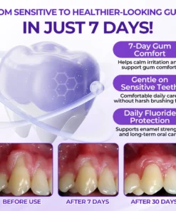 Virexo™ SensiGum Fluoride Toothpaste