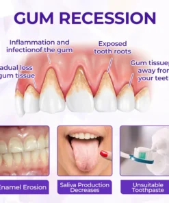 Virexo™ SensiGum Fluoride Toothpaste