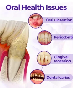 Virexo™ SensiGum Fluoride Toothpaste